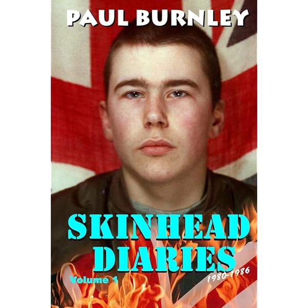 Skins: Gavin Watson : Watson, Gavin: Amazon.fr: Livres